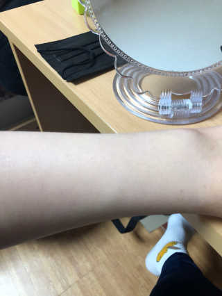 유리스킨- 클렌징 오일  뽀득클렌징오일 — 4.33점을 준 리뷰어가 2018년 2월 올린 사용 사진