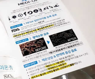 메디덴코 메디업 — 5점을 준 리뷰어가 2018년 3월 올린 사용 사진