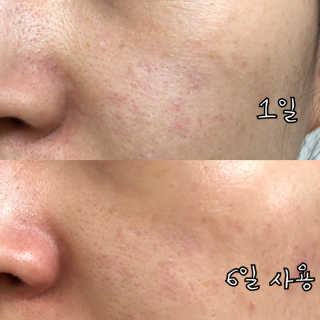 응D님이 올린 리뷰 사진 3