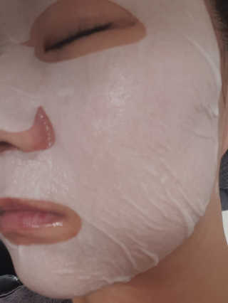 유산균하우스 [프로바이오닉]스킨프로바이오틱스 마스크 10매입 — 5점을 준 리뷰어가 2019년 9월 올린 사용 사진