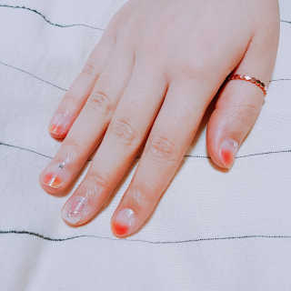 필린 릿티커 — 4점을 준 리뷰어가 2018년 10월 올린 사용 사진