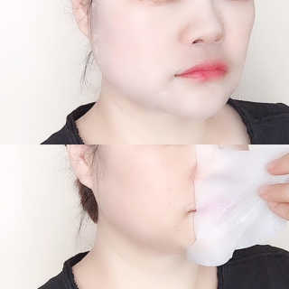 메디힐-엔엠에프＆티트리 안티더스트 카밍 마스크 — 4점을 준 리뷰어가 2019년 2월 올린 사용 사진