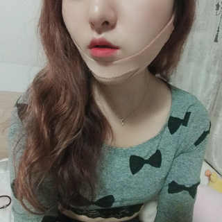 아이디플라코스메틱 아이디 페이스핏 마이너스 밴드 — 4점을 준 리뷰어가 2019년 10월 올린 사용 사진