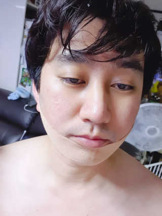 아이디플라코스메틱 아이디 페이스핏 마이너스 밴드 — 2점을 준 리뷰어가 2019년 9월 올린 사용 사진