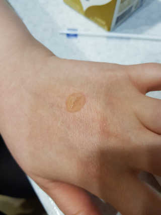 그리니프 얼티밋블레미쉬 솔루션 앰플 30ml — 4.67점을 준 리뷰어가 2019년 1월 올린 사용 사진