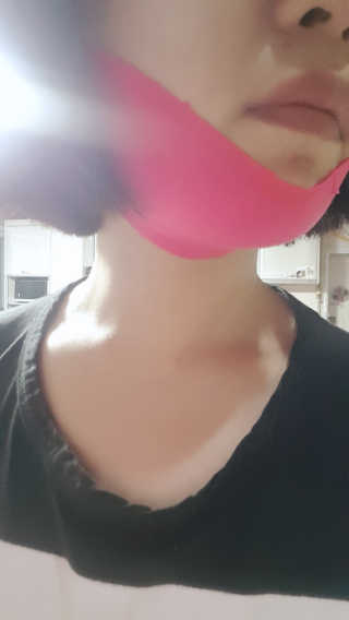스케덤 펩타이드 리프팅밴드 — 4점을 준 리뷰어가 2019년 3월 올린 사용 사진