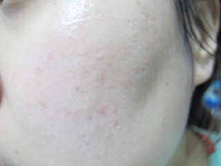 홍블리님이 올린 리뷰 사진 4
