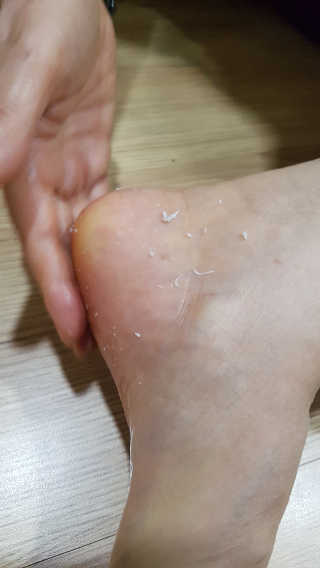 아미니 릴렉싱 풋 필링 스프레이 — 5점을 준 리뷰어가 2019년 4월 올린 사용 사진