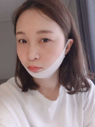 스케덤 클루덤 리프팅 패치 — 5점을 준 리뷰어가 2019년 3월 올린 사용 사진