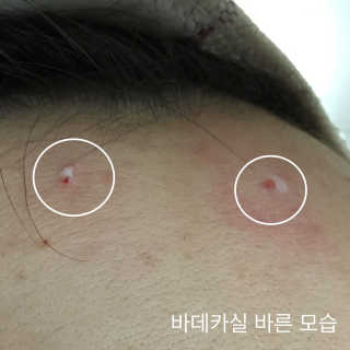 23years old 바데카실 오리지널 — 3.33점을 준 리뷰어가 2017년 12월 올린 사용 사진
