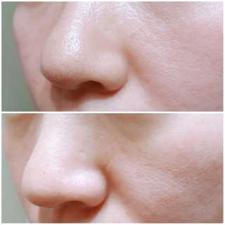 메디힐 슬리핑 멜팅 코팩 — 4.5점을 준 리뷰어가 2020년 1월 올린 사용 사진