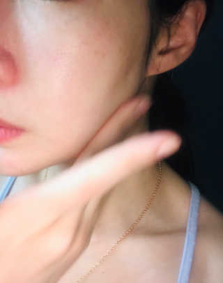 스케덤 클루덤 메디 에프터 크림 — 3.5점을 준 리뷰어가 2019년 7월 올린 사용 사진