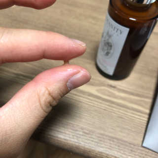 보타니티 [홍]조[진]정[결]케어 플라본 세럼 — 4.67점을 준 리뷰어가 2018년 5월 올린 사용 사진