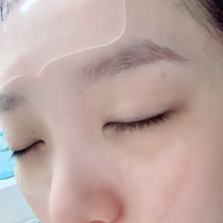 아이디플라코스메틱 아이디 페이스핏 플러스 패치 — 2.5점을 준 리뷰어가 2019년 10월 올린 사용 사진