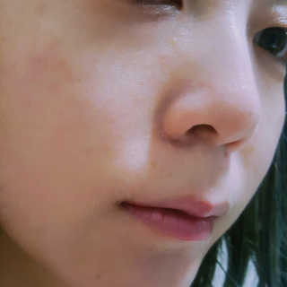 23years old 에어레이닉 포어 마스크 — 3.5점을 준 리뷰어가 2017년 4월 올린 사용 사진