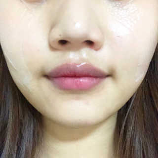 메디타임 멜라반 더마 토닝 씬젤 — 5점을 준 리뷰어가 2019년 6월 올린 사용 사진