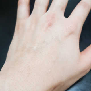 (주)에네스티 에네스티 수안수 실크스킨 풋크림 1+1 — 5점을 준 리뷰어가 2019년 11월 올린 사용 사진