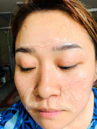 아이디플라코스메틱 아이디 페이스핏 플러스 패치 — 4점을 준 리뷰어가 2019년 10월 올린 사용 사진