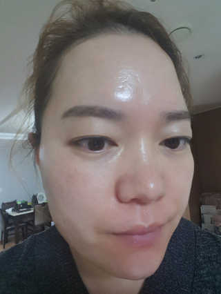 닥터웰메이드원 압구지엔 다이아몬드 링거앰플 — 4.5점을 준 리뷰어가 2019년 1월 올린 사용 사진