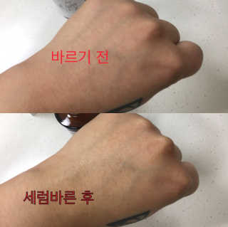 보타니티 [홍]조[진]정[결]케어 플라본 세럼 — 4.67점을 준 리뷰어가 2018년 5월 올린 사용 사진