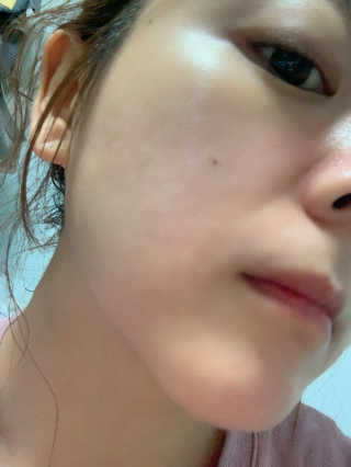 베니테이블 하이드레이팅 부스터 올인원 with PROBIOTICS — 4.5점을 준 리뷰어가 2020년 1월 올린 사용 사진