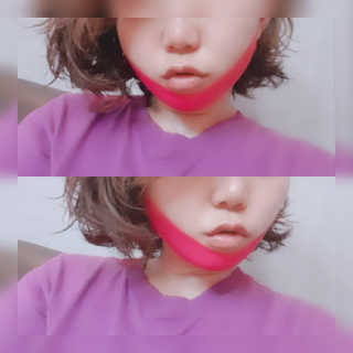 스케덤 펩타이드 리프팅밴드 — 3.5점을 준 리뷰어가 2019년 3월 올린 사용 사진