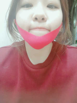 스케덤 펩타이드 리프팅밴드 — 5점을 준 리뷰어가 2019년 3월 올린 사용 사진