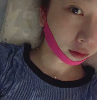 스케덤 펩타이드 리프팅밴드 — 4점을 준 리뷰어가 2019년 5월 올린 사용 사진