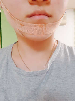 아이디플라코스메틱 아이디 페이스핏 마이너스 밴드 — 4점을 준 리뷰어가 2019년 9월 올린 사용 사진