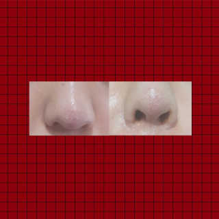 [22도씨] 라클 화이트닝 크림 80ml — 1점을 준 리뷰어가 2019년 8월 올린 사용 사진