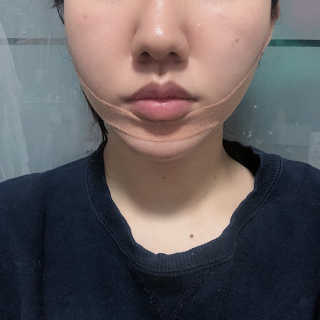 아이디플라코스메틱 아이디 페이스핏 마이너스 밴드 — 5점을 준 리뷰어가 2020년 1월 올린 사용 사진