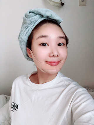 아이디플라코스메틱 아이디 페이스핏 마이너스 밴드 — 4.5점을 준 리뷰어가 2019년 9월 올린 사용 사진