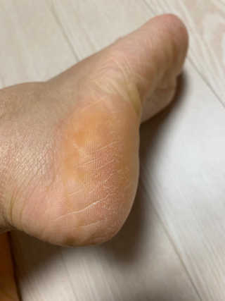 유어비 부탁해 발 부탁해 발 글라스 풋 파일 — 5점을 준 리뷰어가 2019년 4월 올린 사용 사진