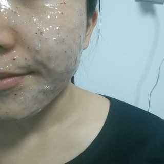 23years old 아쿠아밥 모델링 마스크 — 4.5점을 준 리뷰어가 2018년 3월 올린 사용 사진