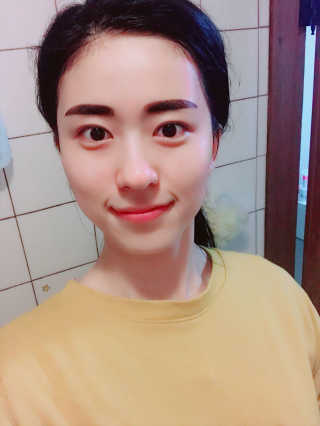 벤튼 스네일비 하이콘텐트 에센스 — 4.67점을 준 리뷰어가 2018년 4월 올린 사용 사진