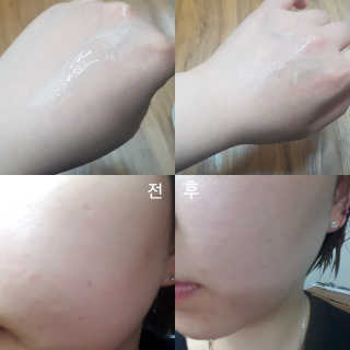 2018 아이소이 잡티세럼 리미티드 컬렉션 — 3.33점을 준 리뷰어가 2018년 4월 올린 사용 사진