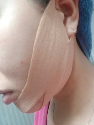 아이디플라코스메틱 아이디 페이스핏 마이너스 밴드 — 5점을 준 리뷰어가 2020년 3월 올린 사용 사진