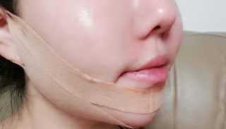 아이디플라코스메틱 아이디 페이스핏 마이너스 밴드 — 5점을 준 리뷰어가 2019년 11월 올린 사용 사진