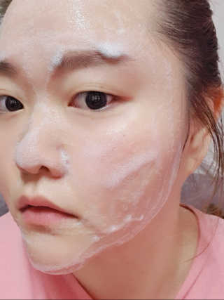 세바메드 안티박테리얼 클렌징 폼 — 5점을 준 리뷰어가 2020년 1월 올린 사용 사진