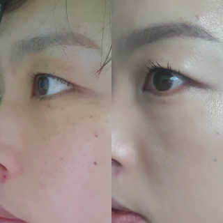 라임코스메틱 V 콜라겐 앰플 쿠션 — 5점을 준 리뷰어가 2020년 1월 올린 사용 사진