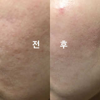 나이팅게일-토닝 필링패드 허니 — 4.17점을 준 리뷰어가 2017년 9월 올린 사용 사진