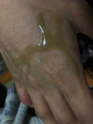 보타니티 [홍]조[진]정[결]케어 플라본 세럼 — 5점을 준 리뷰어가 2018년 5월 올린 사용 사진