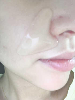 아이디플라코스메틱 아이디 페이스핏 플러스 패치 — 3점을 준 리뷰어가 2019년 10월 올린 사용 사진