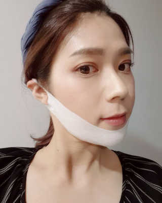스케덤 클루덤 리프팅 패치 — 4점을 준 리뷰어가 2019년 3월 올린 사용 사진