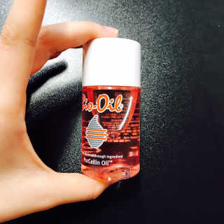 Bio-oil(바이오오일) 바이오오일(Bio-oil) — 4점을 준 리뷰어가 2017년 1월 올린 사용 사진