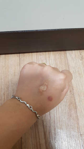 본다움 알로에 베라 수딩젤 — 5점을 준 리뷰어가 2019년 6월 올린 사용 사진