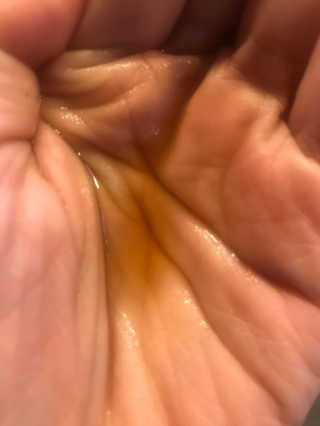 다슈코리아 다슈 안티 헤어로스 허브 헤어토닉 — 4점을 준 리뷰어가 2017년 11월 올린 사용 사진