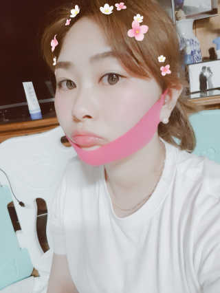 스케덤 펩타이드 리프팅밴드 — 5점을 준 리뷰어가 2019년 5월 올린 사용 사진