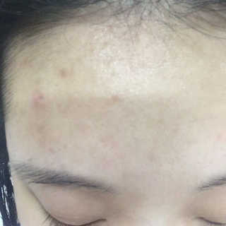 23years old 바데카실P — 3.5점을 준 리뷰어가 2017년 1월 올린 사용 사진