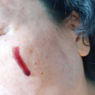 쏘내추럴 레드 필 팅글 세럼 오리지널 — 4.5점을 준 리뷰어가 2019년 8월 올린 사용 사진